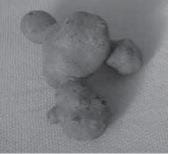 Knobby potato